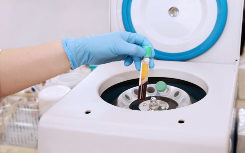 Utilizzo del PRF in medicina rigenerativa per guarigione dei tessuti