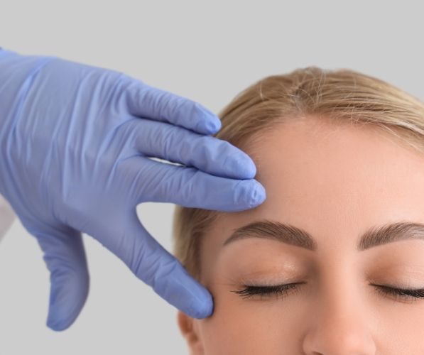 Trattamento di blefaroplastica non ablativa con laser frazionato sulla palpebra superiore di una donna adulta.