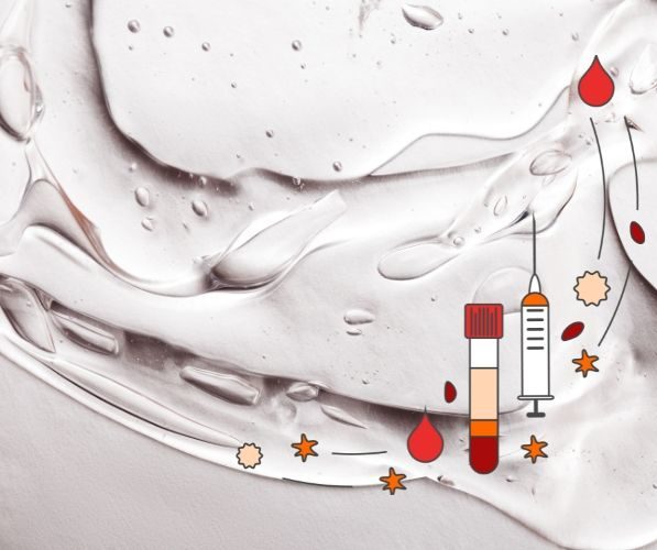 i-prf gel piastrinico