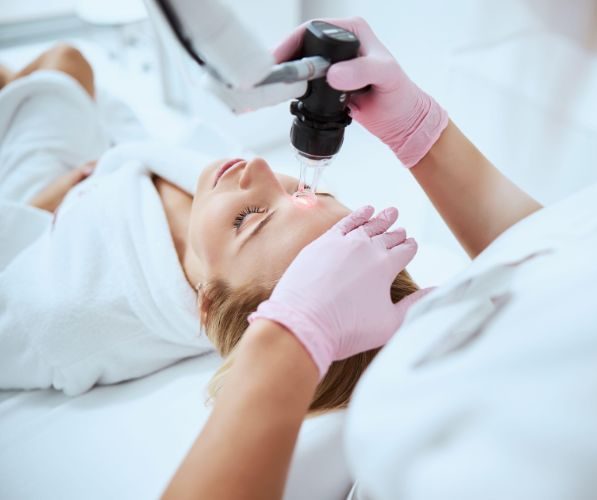 Rimuovere le rughe col laser