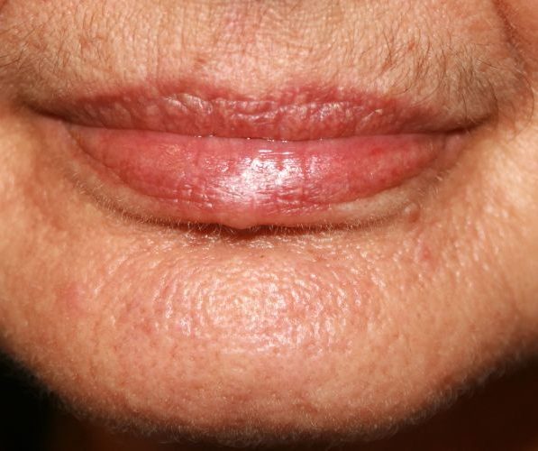 Eliminazione codice a barre