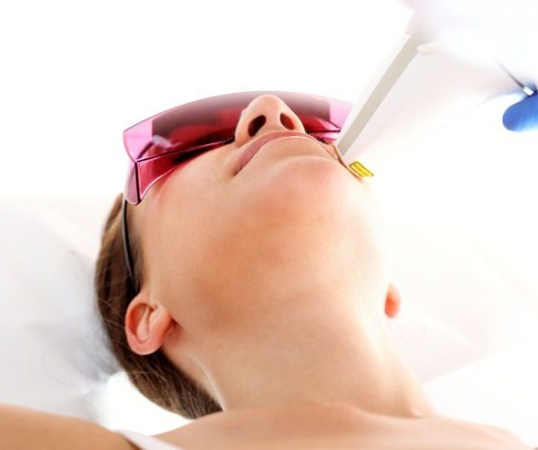 Differenza tra laser Co2 e Yag